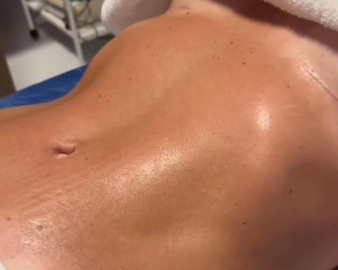 fisioterapia pós operatório em Maceió